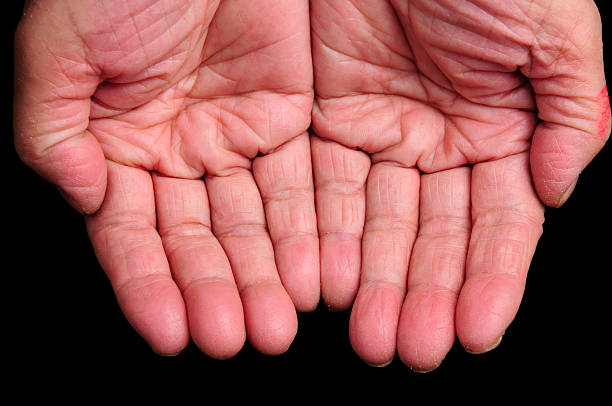 Two open hands against a black background